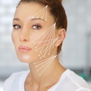 Morpheus8 Takes Center Stage as the New Non-surgical Facelift - Essex Med  Spa