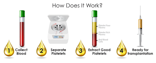 PRP Graphic