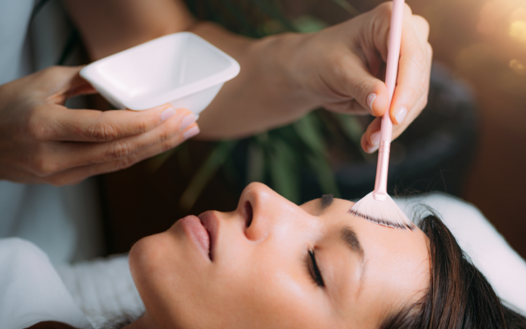 Your Guide to VI Peel and Chemical Peel Aftercare Essex Med Spa