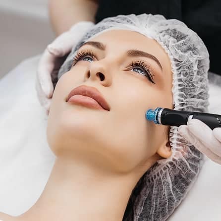 Microneedling (CIT) min