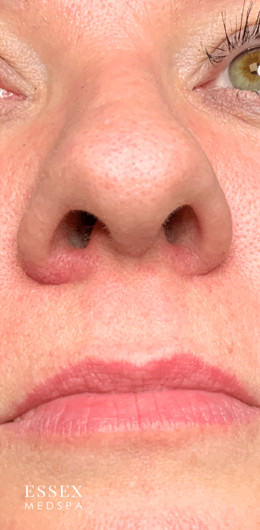 After Image: Thermo-Lo - front