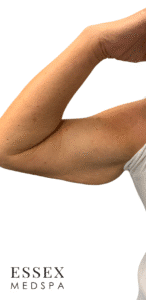 After Image: EvolveX Arms
