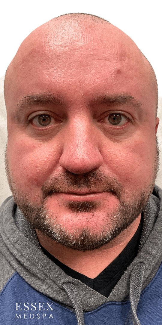 After Image: IPL - front