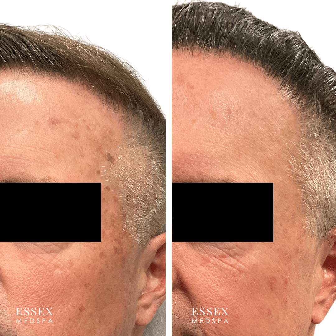 Copy of B. Calton, IPL