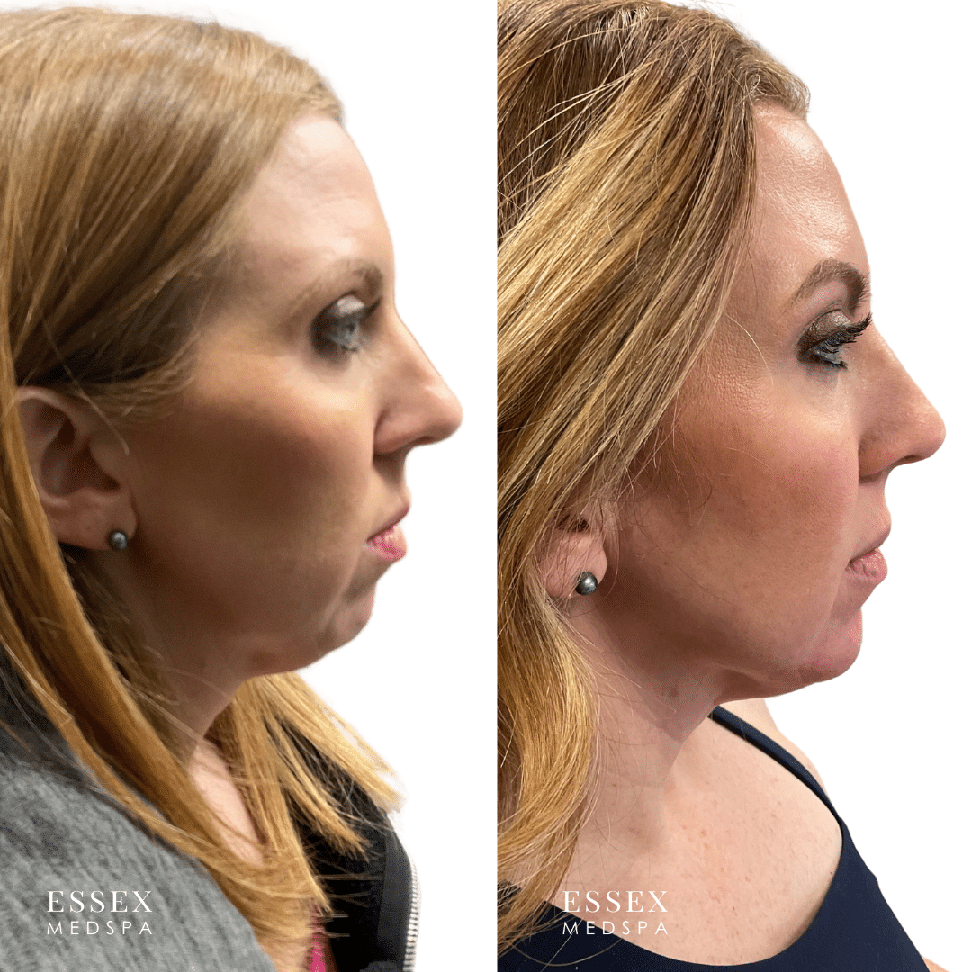 Earle, Facial Balancing