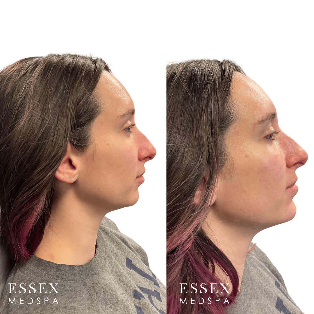 Facial Balancing Gaiennie