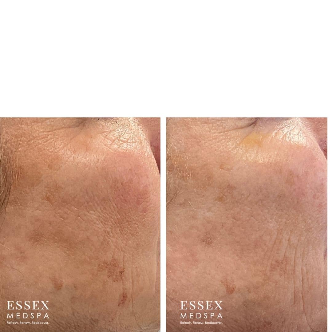 Smaldone Before & After